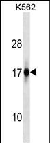 WB - ZFAND2A Antibody (Center) AP18044c