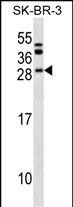 BCL7C Antibody (N-term) (Cat. #AP18065a) western blot analysis in SK-BR-3 cell line lysates (35ug/lane).This demonstrates the BCL7C antibody detected the BCL7C protein (arrow).