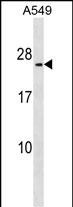 WB - METTL7B Antibody (N-term) AP18067a