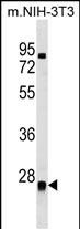 WB - METTL7B Antibody (N-term) AP18067a