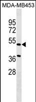 WB - NPNT Antibody (Center) AP18069c