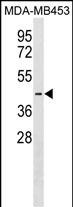 WB - PJVK Antibody (Center) AP18071c