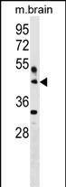 WB - HAPLN4 Antibody (C-term) AP18081B