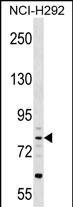 WB - CRTAC1 Antibody (N-term) AP18087a