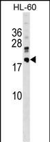 WB - DNAJC30 Antibody (C-term) AP18088b