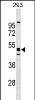 WB - MTL5 Antibody (C-term) AP18102b
