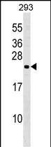 WB - N6AMT1 Antibody (N-term) AP18103a