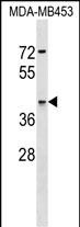 ARSA Antibody (C-term) (Cat. #AP18128b) western blot analysis in MDA-MB453 cell line lysates (35ug/lane).This demonstrates the ARSA antibody detected the ARSA protein (arrow).