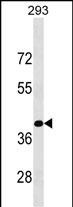 WB - KLF15 Antibody (C-term) AP18136b