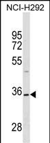 WB - TSPAN18 Antibody (Center) AP18147c