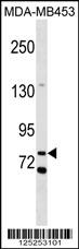 WB - COL12 Antibody (N-term) AP18157A