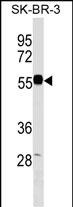 WB - EEPD1 Antibody (C-term) AP18169b