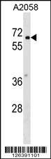 WB - PYRD2 Antibody (N-term) AP18172a