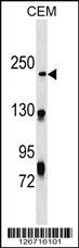 WB - NHSL1 Antibody (Center) AP18178c