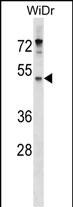WB - ENPP4 Antibody (Center) AP18179c