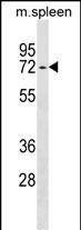 ENTPD4 Antibody (N-term) (Cat. #AP18180a) western blot analysis in mouse spleen tissue lysates (35ug/lane).This demonstrates the ENTPD4 antibody detected the ENTPD4 protein (arrow).