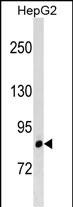 WB - LRRIQ3 Antibody (C-term) AP18197b