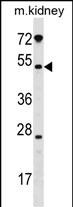WB - GALNT13 Antibody (Center) AP18212c