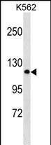 PCDHA2 Antibody (N-term) (Cat. #AP18218a) western blot analysis in K562 cell line lysates (35ug/lane).This demonstrates the PCDHA2 antibody detected the PCDHA2 protein (arrow).