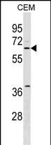 WB - SPS2L Antibody (N-term) AP18222a