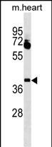 WB - LBX1 Antibody (Center) AP18241c