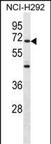 WB - ZNF568 Antibody (Center) AP18245c