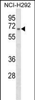 WB - ZNF682 Antibody (Center) AP18246C