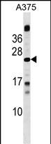 WB - MBD3L1 Antibody (C-term) AP18250b