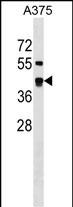 WB - SDSL Antibody (N-term) AP18252a