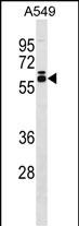 WB - DUS2L Antibody (C-term) AP18265b