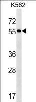 WB - FRMD8 Antibody (N-term) AP18270a