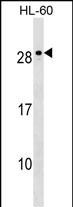 WB - MED18 Antibody (C-term) AP18275B