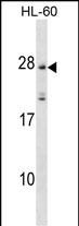 WB - MS4A5 Antibody (N-term) AP18276a