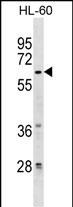 WB - ZNF317 Antibody (Center) AP18287c