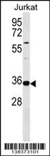 WB - TRNAU1AP Antibody (Center) AP18294c