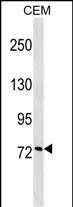 CCNF Antibody (Center) (Cat. #AP18322c) western blot analysis in CEM cell line lysates (35ug/lane).This demonstrates the CCNF Antibody detected the CCNF protein (arrow).