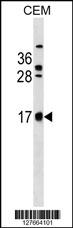 WB - CB083 Antibody (C-term) AP18329b