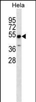 WB - ZSCAN4 Antibody (N-term) AP18335A