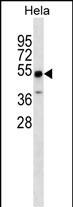 ZSCAN4 Antibody (N-term) (Cat. #AP18335a) western blot analysis in Hela cell line lysates (35ug/lane).This demonstrates the ZSCAN4 Antibody detected the ZSCAN4 protein (arrow).