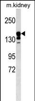 WB - ABCC9 Antibody (Center) AP18353c