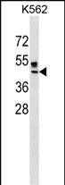 ZNRF4 Antibody (N-term) (Cat. #AP18372a) western blot analysis in K562 cell line lysates (35ug/lane).This demonstrates the ZNRF4 Antibody detected the ZNRF4 protein (arrow).