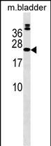 WB - COMMD10 Antibody (Center) AP18374c