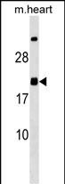 WB - MED9 Antibody (C-term) AP18376b