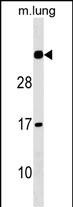 WB - NAT15 Antibody (Center) AP18377c