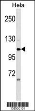 WB - ZNF33A Antibody (N-term) AP18422a