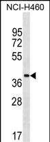 WB - ZNF488 Antibody (Center) AP18433c