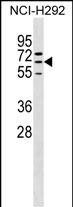 WB - ZNF599 Antibody (N-term) AP18435a