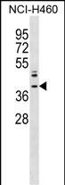 WB - ZNF75A Antibody (Center) AP18436c