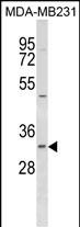 WB - FAHD2B Antibody (C-term) AP18443b