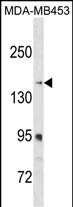 RRBP1 Antibody (C-term) (Cat. #AP18468b) western blot analysis in MDA-MB453 cell line lysates (35ug/lane).This demonstrates the RRBP1 antibody detected the RRBP1 protein (arrow).